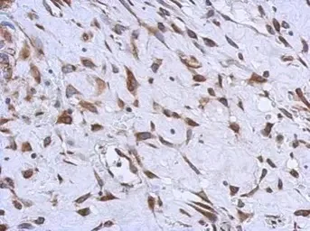 Immunohistochemistry (Formalin/PFA-fixed paraffin-embedded sections) - Anti-MMACHC/CblC antibody (AB96195)