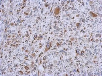 Immunohistochemistry (Formalin/PFA-fixed paraffin-embedded sections) - Anti-MMACHC/CblC antibody (AB96195)