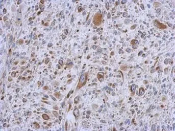 Immunohistochemistry (Formalin/PFA-fixed paraffin-embedded sections) - Anti-MMACHC/CblC antibody (AB96195)
