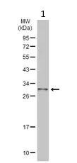Western blot - Anti-MMACHC/CblC antibody (AB96195)