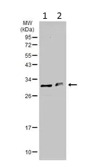 Western blot - Anti-MMACHC/CblC antibody (AB96195)