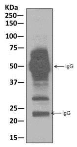 Immunoprecipitation - Anti-MMACHC/CblC antibody [EPR11268] - BSA and Azide free (AB250026), expandable thumbnail