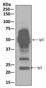 Immunoprecipitation - Anti-MMACHC/CblC antibody [EPR11268] - BSA and Azide free (AB250026)