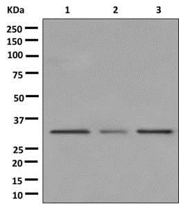 Western blot - Anti-MMACHC/CblC antibody [EPR11268] - BSA and Azide free (AB250026), expandable thumbnail