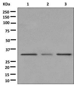 Western blot - Anti-MMACHC/CblC antibody [EPR11268] - BSA and Azide free (AB250026)