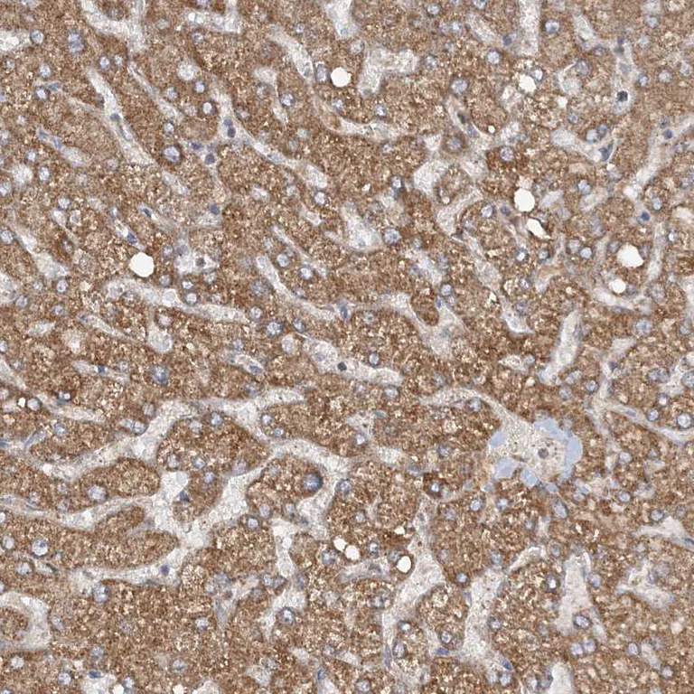 Immunohistochemistry (Formalin/PFA-fixed paraffin-embedded sections) - Anti-MMADHC antibody (AB204313)