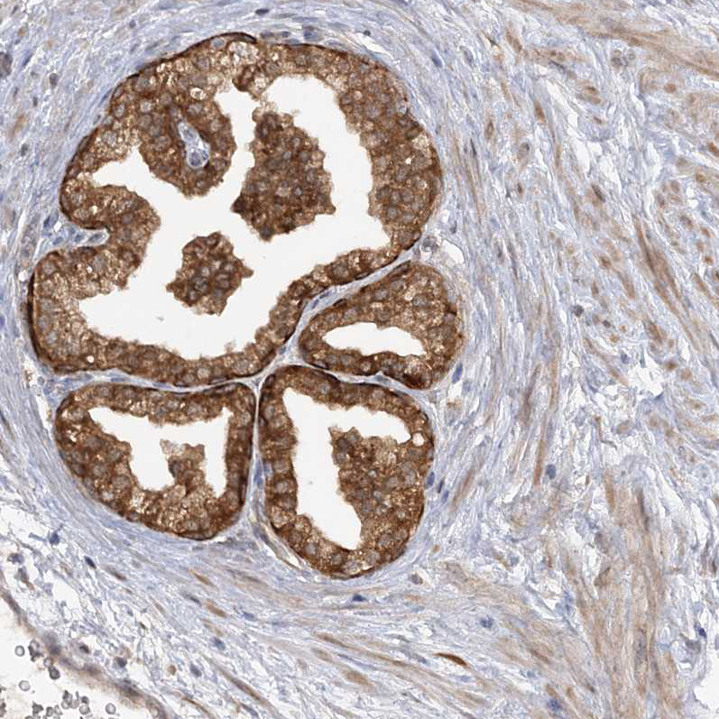 Immunohistochemistry (Formalin/PFA-fixed paraffin-embedded sections) - Anti-MMADHC antibody (AB204313), expandable thumbnail