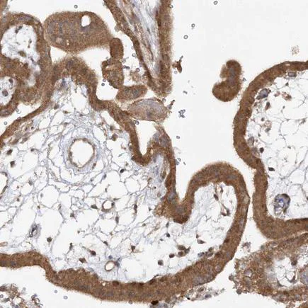 Immunohistochemistry (Formalin/PFA-fixed paraffin-embedded sections) - Anti-MMADHC antibody (AB204313)