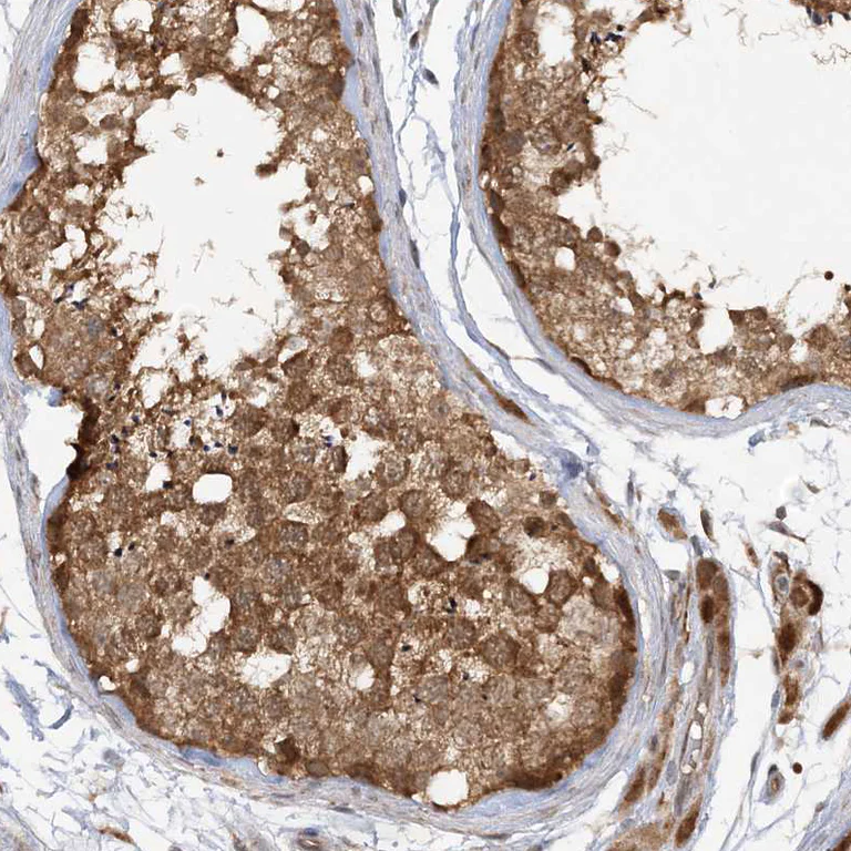 Immunohistochemistry (Formalin/PFA-fixed paraffin-embedded sections) - Anti-MMADHC antibody (AB204313)