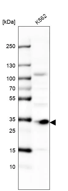 Western blot - Anti-MMADHC antibody (AB204313)