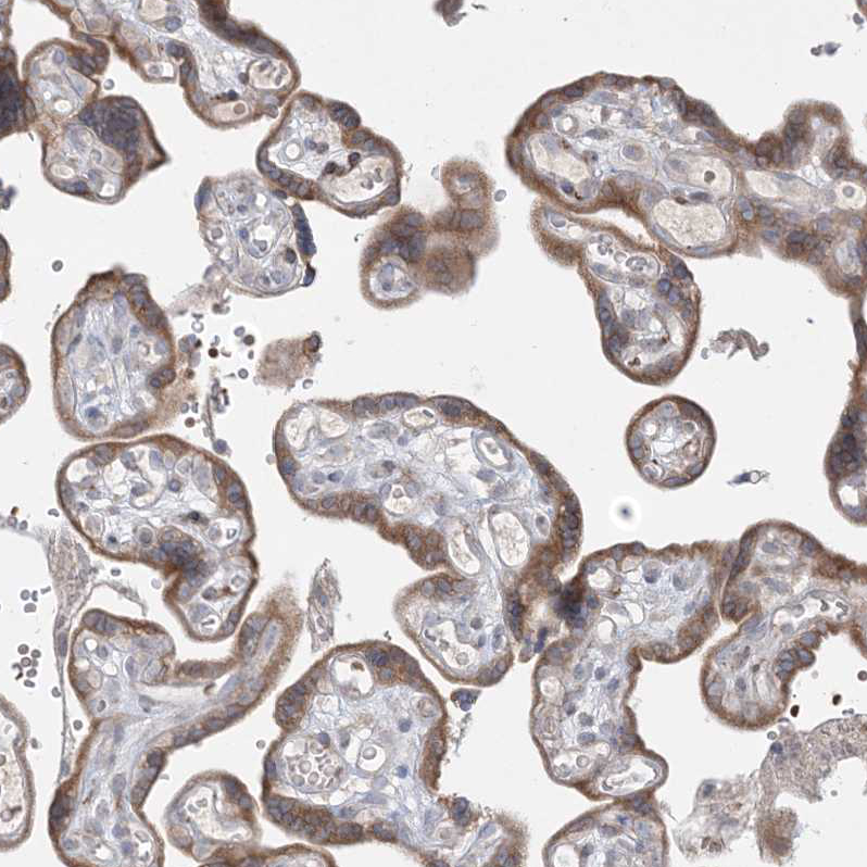 Immunohistochemistry (Formalin/PFA-fixed paraffin-embedded sections) - Anti-MMGT1 antibody (AB122202)