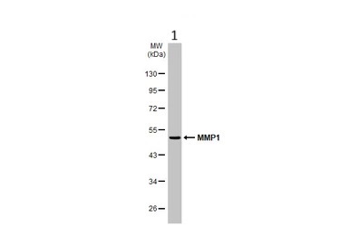 Anti-MMP1 antibody