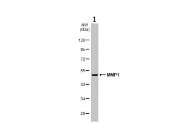 Western blot - Anti-MMP1 antibody (AB137332)