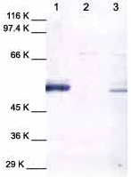 Western blot - Anti-MMP1 antibody (AB38929), expandable thumbnail
