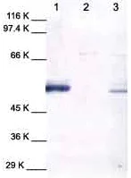 Western blot - Anti-MMP1 antibody (AB38929)