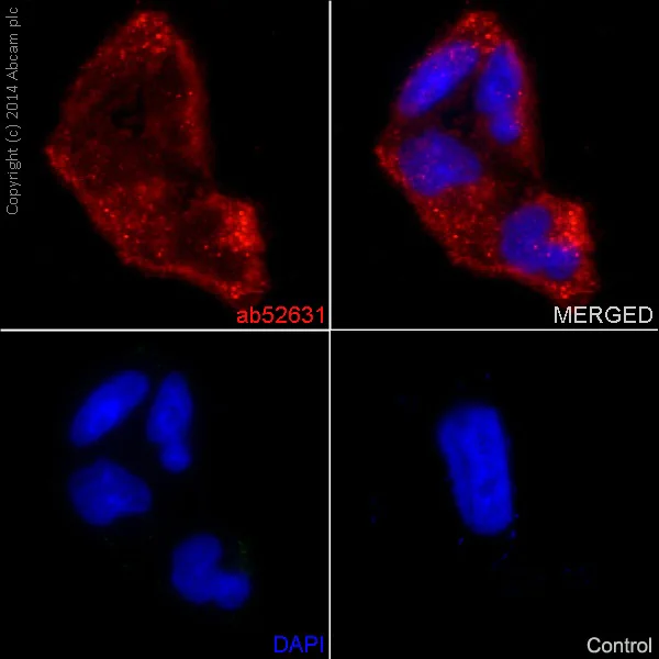 Immunocytochemistry/ Immunofluorescence - Anti-MMP1 antibody [EP1247Y] (AB52631)