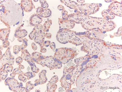 Immunohistochemistry (Formalin/PFA-fixed paraffin-embedded sections) - Anti-MMP1 antibody [EP1247Y] (AB52631)