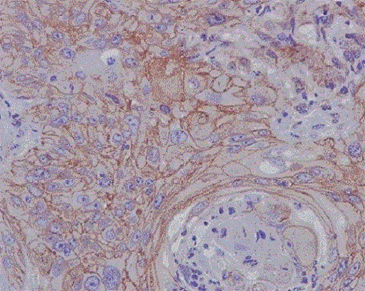 Immunohistochemistry (Formalin/PFA-fixed paraffin-embedded sections) - Anti-MMP1 antibody [EP1247Y] - BSA and Azide free (AB271845), expandable thumbnail