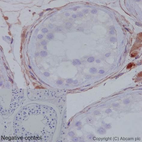 Immunohistochemistry (Formalin/PFA-fixed paraffin-embedded sections) - Anti-MMP1 antibody [EP1247Y] - Low endotoxin, Azide free (AB215979), expandable thumbnail