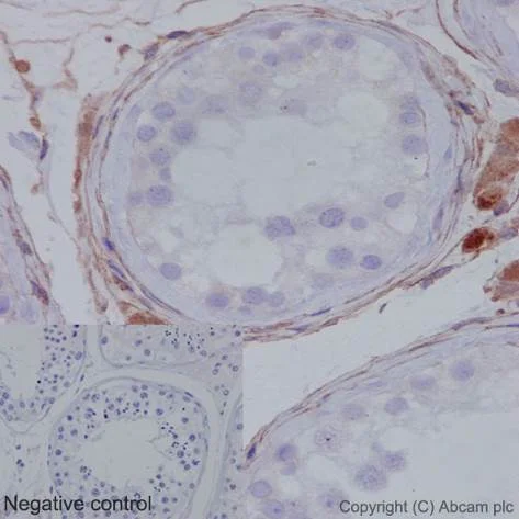 Immunohistochemistry (Formalin/PFA-fixed paraffin-embedded sections) - Anti-MMP1 antibody [EP1247Y] - Low endotoxin, Azide free (AB215979)