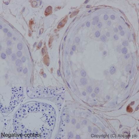 Immunohistochemistry (Formalin/PFA-fixed paraffin-embedded sections) - Anti-MMP1 antibody [EP1247Y] - Low endotoxin, Azide free (AB215979), expandable thumbnail