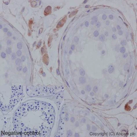 Immunohistochemistry (Formalin/PFA-fixed paraffin-embedded sections) - Anti-MMP1 antibody [EP1247Y] - Low endotoxin, Azide free (AB215979)