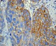 Immunohistochemistry (Formalin/PFA-fixed paraffin-embedded sections) - Anti-MMP1 antibody [EP1247Y] - Low endotoxin, Azide free (ab215979), expandable thumbnail