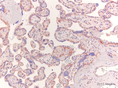 Immunohistochemistry (Formalin/PFA-fixed paraffin-embedded sections) - Anti-MMP1 antibody [EP1247Y] - Low endotoxin, Azide free (AB215979), expandable thumbnail