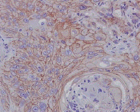 Immunohistochemistry (Formalin/PFA-fixed paraffin-embedded sections) - Anti-MMP1 antibody [EP1247Y] - Low endotoxin, Azide free (AB215979), expandable thumbnail