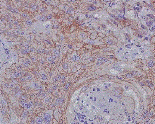 Immunohistochemistry (Formalin/PFA-fixed paraffin-embedded sections) - Anti-MMP1 antibody [EP1247Y] - Low endotoxin, Azide free (AB215979)