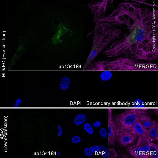 Immunocytochemistry/ Immunofluorescence - Anti-MMP1 antibody [EP1249Y] (AB134184)