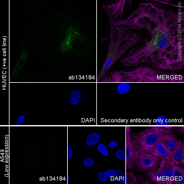 Immunocytochemistry/ Immunofluorescence - Anti-MMP1 antibody [EP1249Y] - BSA and Azide free (AB240086), expandable thumbnail