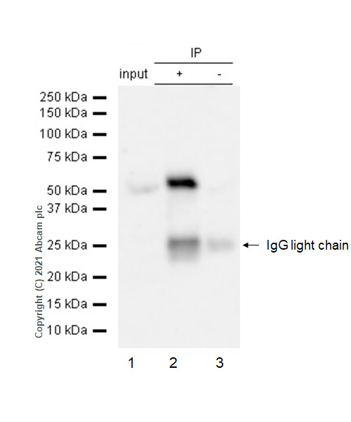 Immunoprecipitation - Anti-MMP1 antibody [EP1249Y] - BSA and Azide free (AB240086), expandable thumbnail