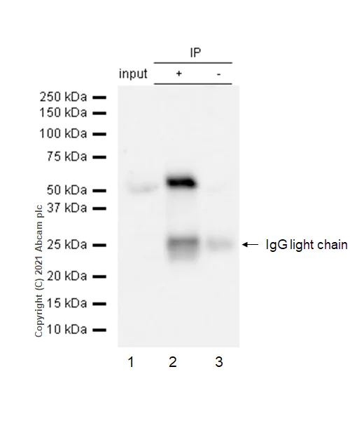 Immunoprecipitation - Anti-MMP1 antibody [EP1249Y] - BSA and Azide free (AB240086)