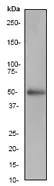 Western blot - Anti-MMP1 antibody [EP1249Y] - BSA and Azide free (AB240086)