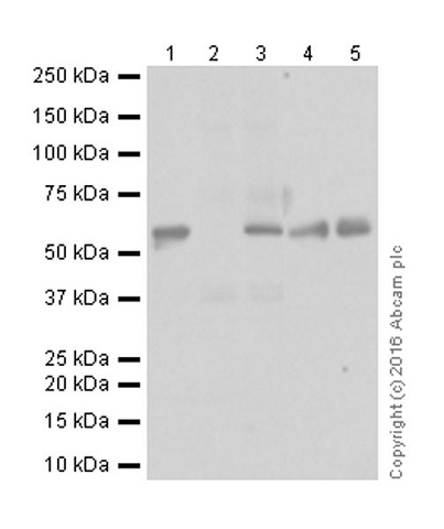Western blot - Anti-MMP1 antibody [EP1249Y] - BSA and Azide free (AB240086), expandable thumbnail
