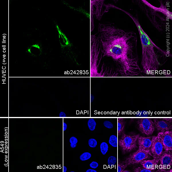 Immunocytochemistry/ Immunofluorescence - Anti-MMP1 antibody [EPR19769-152] - BSA and Azide free (Detector) (AB242835)