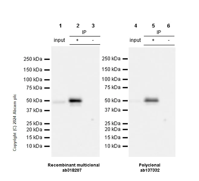 Immunoprecipitation - Anti-MMP1 antibody [RM1206] (AB318207)