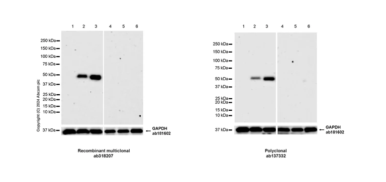 Western blot - Anti-MMP1 antibody [RM1206] (AB318207)