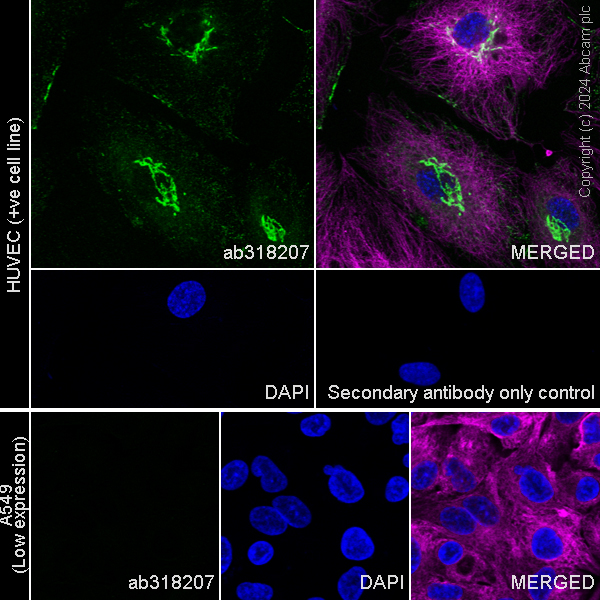 Immunocytochemistry/ Immunofluorescence - Anti-MMP1 antibody [RM1206] - BSA and Azide free (AB318208), expandable thumbnail