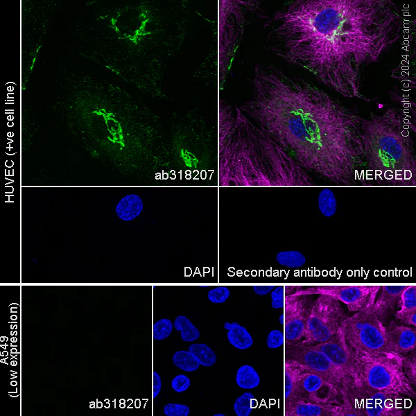 Immunocytochemistry/ Immunofluorescence - Anti-MMP1 antibody [RM1206] - BSA and Azide free (AB318208)