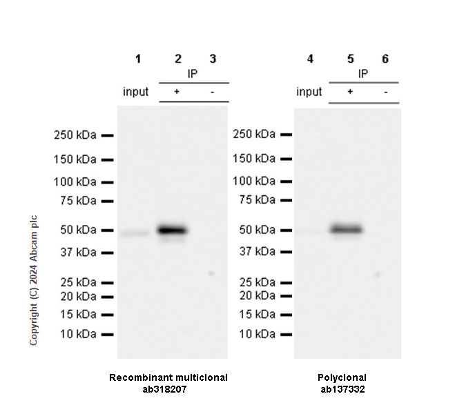 Immunoprecipitation - Anti-MMP1 antibody [RM1206] - BSA and Azide free (AB318208), expandable thumbnail