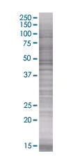 SDS-PAGE - MMP1 overexpression 293T lysate (whole cell) (AB94053)