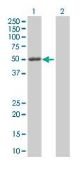Western blot - MMP1 overexpression 293T lysate (whole cell) (AB94053)