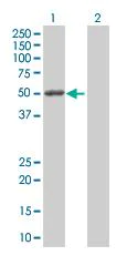 Western blot - MMP1 overexpression 293T lysate (whole cell) (AB94053)
