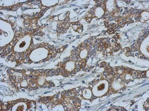 Immunohistochemistry (Formalin/PFA-fixed paraffin-embedded sections) - Anti-MMP10 antibody (AB227238)