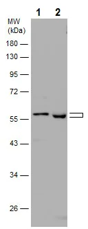 Western blot - Anti-MMP10 antibody (AB227238)