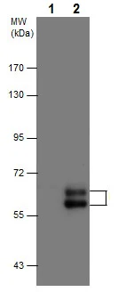 Western blot - Anti-MMP10 antibody (AB227238)