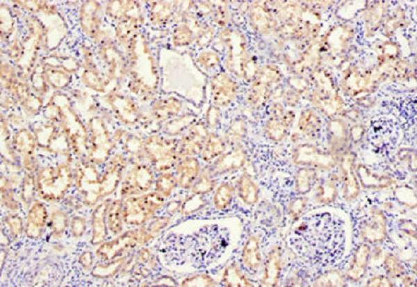 Immunohistochemistry (Formalin/PFA-fixed paraffin-embedded sections) - Anti-MMP10 antibody (AB261733)