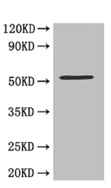 Western blot - Anti-MMP10 antibody (AB261733)